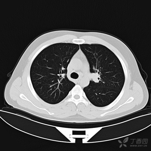 咳嗽症状肺炎宝宝有什么影响_宝宝咳嗽肺炎什么症状有哪些_宝宝肺炎咳嗽会传染宝宝吗