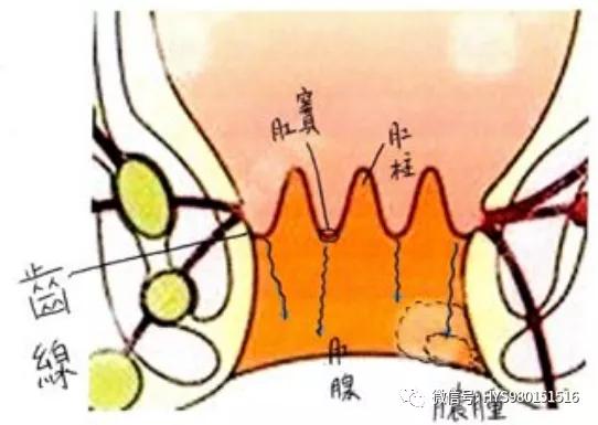 肛门手术引起失禁肛瘘的原因_肛门手术引起失禁肛瘘怎么治疗_肛瘘手术引起肛门失禁