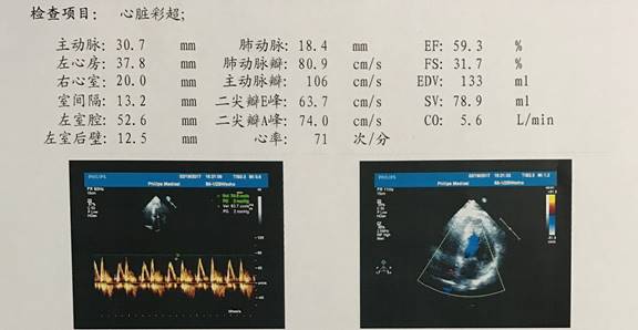 冠心病病例书写_书写病例冠心病的模板_冠心病诊断病历书写顺序